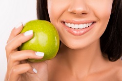 smiling woman holding green apple near white teeth, Joliet, IL dental implants